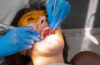 Oral Surgery